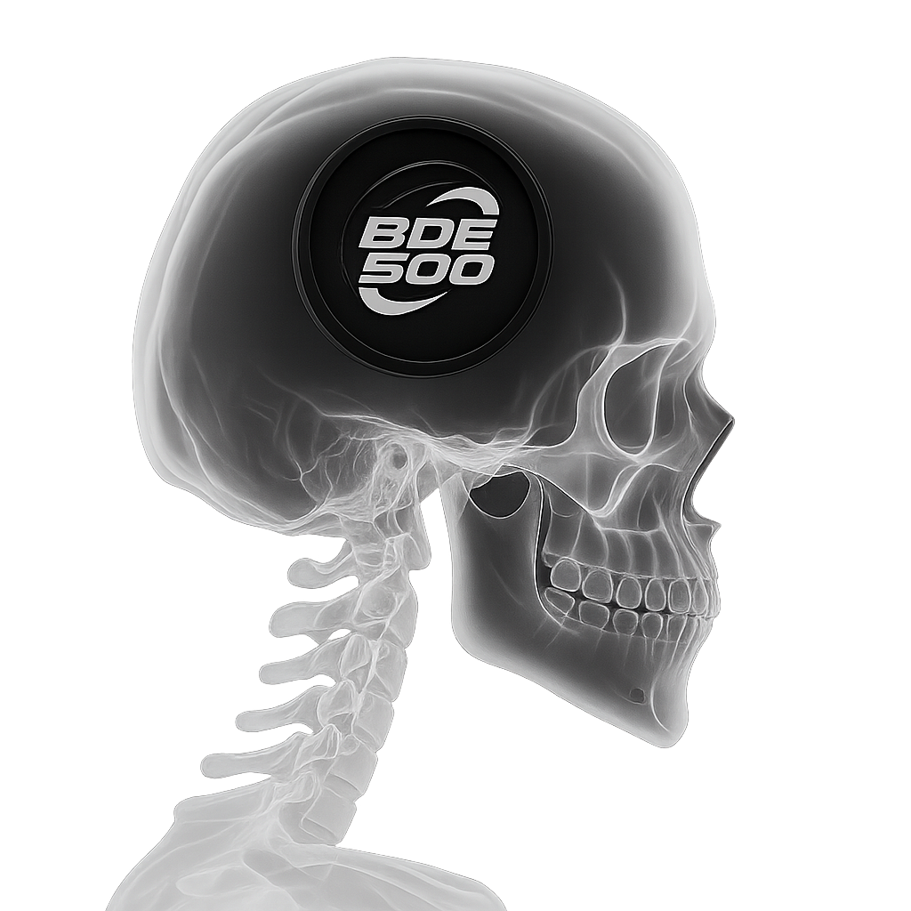 BDE 500 X-ray Skull